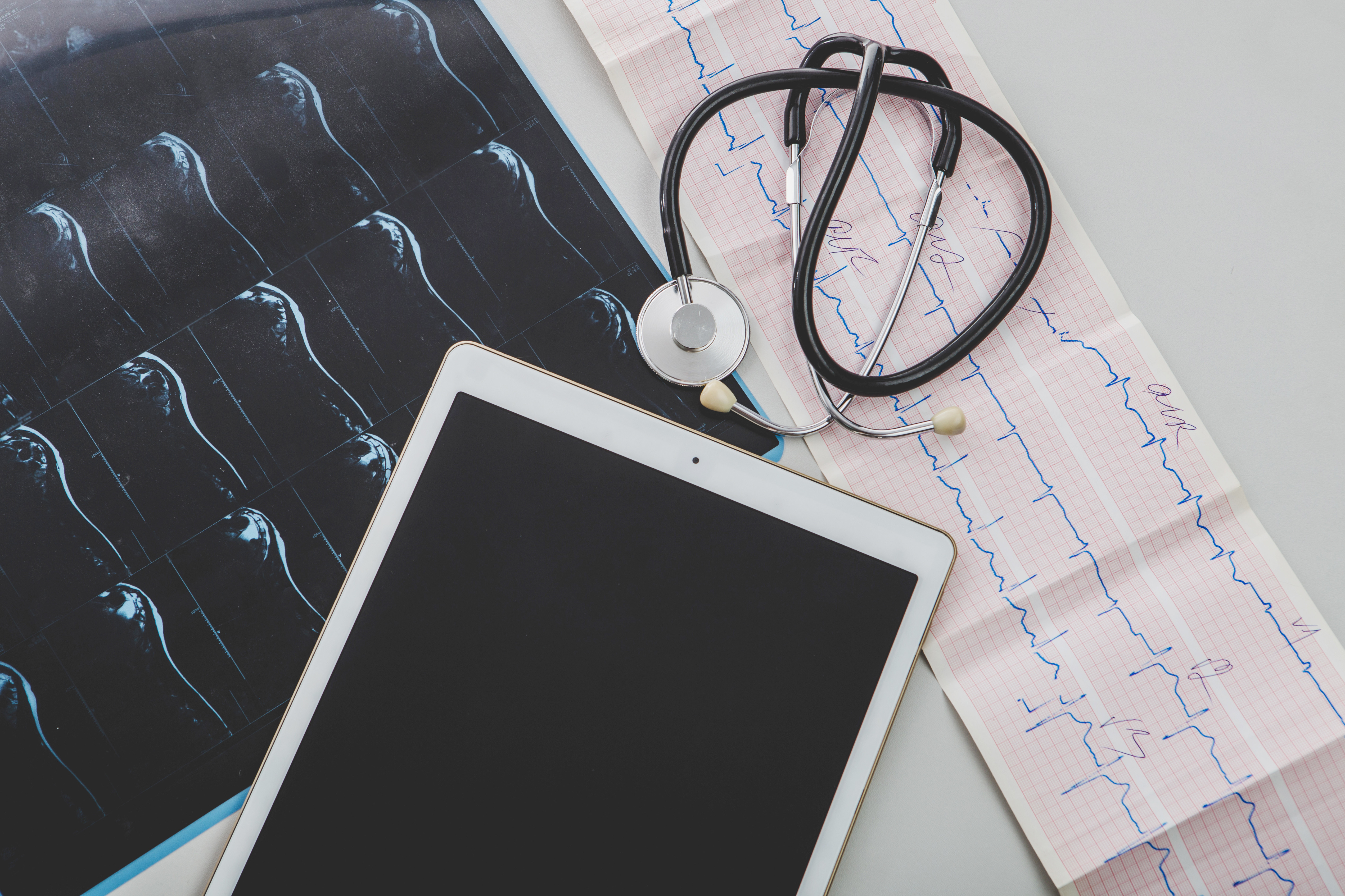 Eletrocardiograma (ECG): simples, rápido e pode salvar vidas
