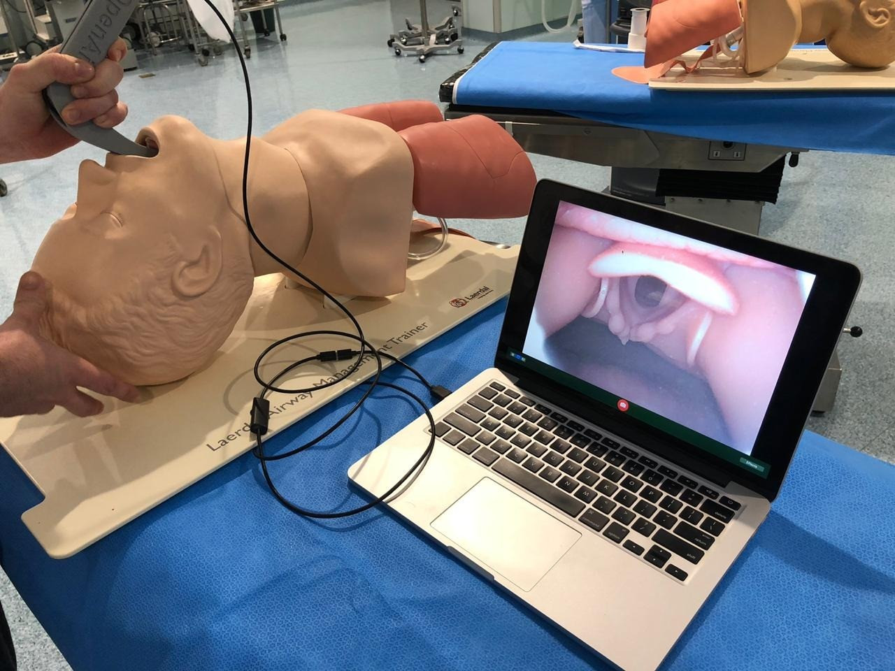 Projeto do PROADI-SUS desenvolve aparelho inovador 3D que otimiza a intubação de pacientes com COVID-19 na rede pública 